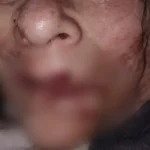 Enfermero denunciado en geriátrico de Mar del Plata