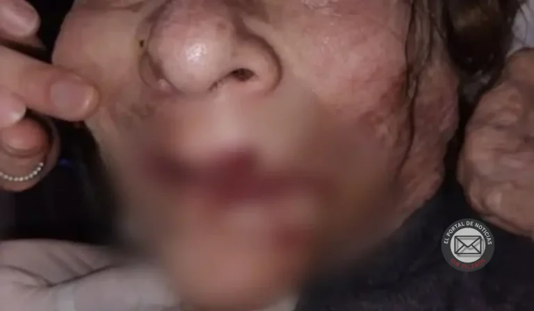 Enfermero denunciado en geriátrico de Mar del Plata